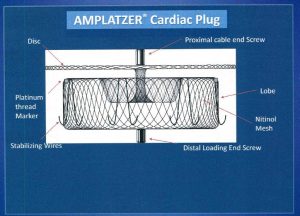 図８B　Amplatzer Cardiac Plug