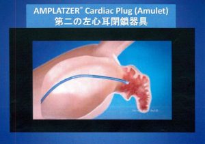 図8A Amplatzer Cardiac Plug